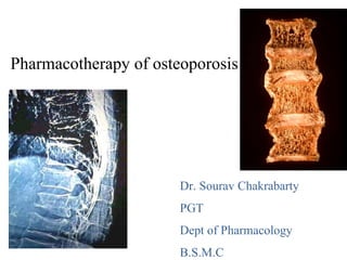 Pharmacotherapy of osteoporosis
Dr. Sourav Chakrabarty
PGT
Dept of Pharmacology
B.S.M.C
 