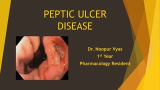 PEPTIC ULCER
DISEASE
Dr. Noopur Vyas
1st Year
Pharmacology Resident
 