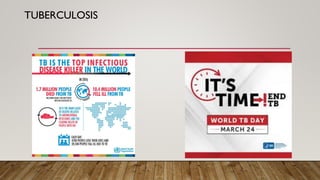 TUBERCULOSIS
 
