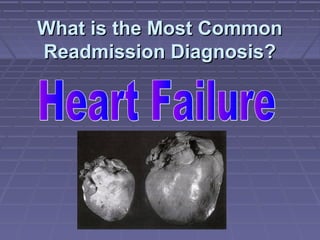 What is the Most CommonWhat is the Most Common
Readmission Diagnosis?Readmission Diagnosis?
 