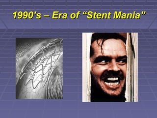 1990’s – Era of “Stent Mania”1990’s – Era of “Stent Mania”
 