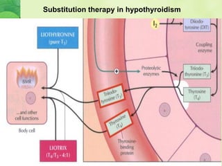 Substitution therapy in hypothyroidism
 