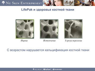 Норма Истончение Угроза перелома
LifePak и здоровье костной ткани
С возрастом нарушается кальцификация костной ткани
 
