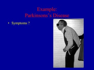 Example:
Parkinsons’s Disease
• Symptoms ?

 
