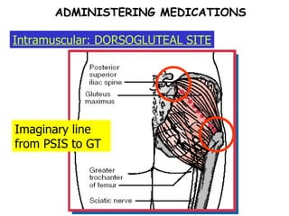 ADMINISTERING MEDICATIONS Intramuscular: DORSOGLUTEAL SITE Imaginary line from PSIS to GT 