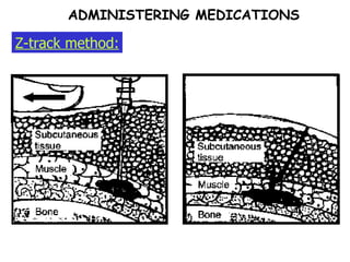 Z-track method: ADMINISTERING MEDICATIONS 