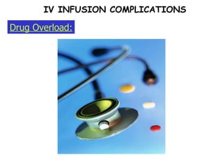 Drug Overload: IV INFUSION COMPLICATIONS 