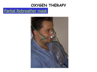Partial Rebreather mask OXYGEN THERAPY 
