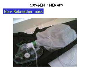 OXYGEN THERAPY Non- Rebreather mask 