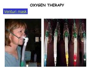 OXYGEN THERAPY Venturi mask 