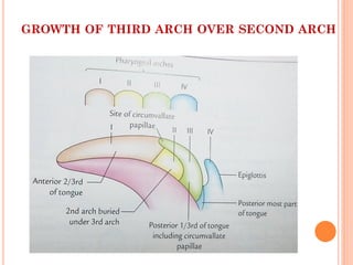 GROWTH OF THIRD ARCH OVER SECOND ARCH
 