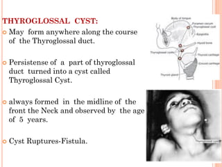 THYROGLOSSAL CYST:
 May form anywhere along the course
of the Thyroglossal duct.
 Persistense of a part of thyroglossal
duct turned into a cyst called
Thyroglossal Cyst.
 always formed in the midline of the
front the Neck and observed by the age
of 5 years.
 Cyst Ruptures-Fistula.
 