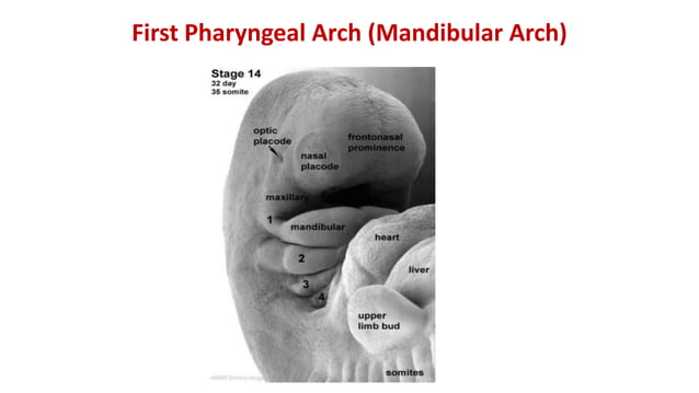 Pharyngeal arches | PPTX | Ear, Nose and Throat Conditions | Diseases ...