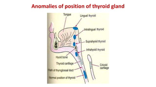 Anomalies of position of thyroid gland
 