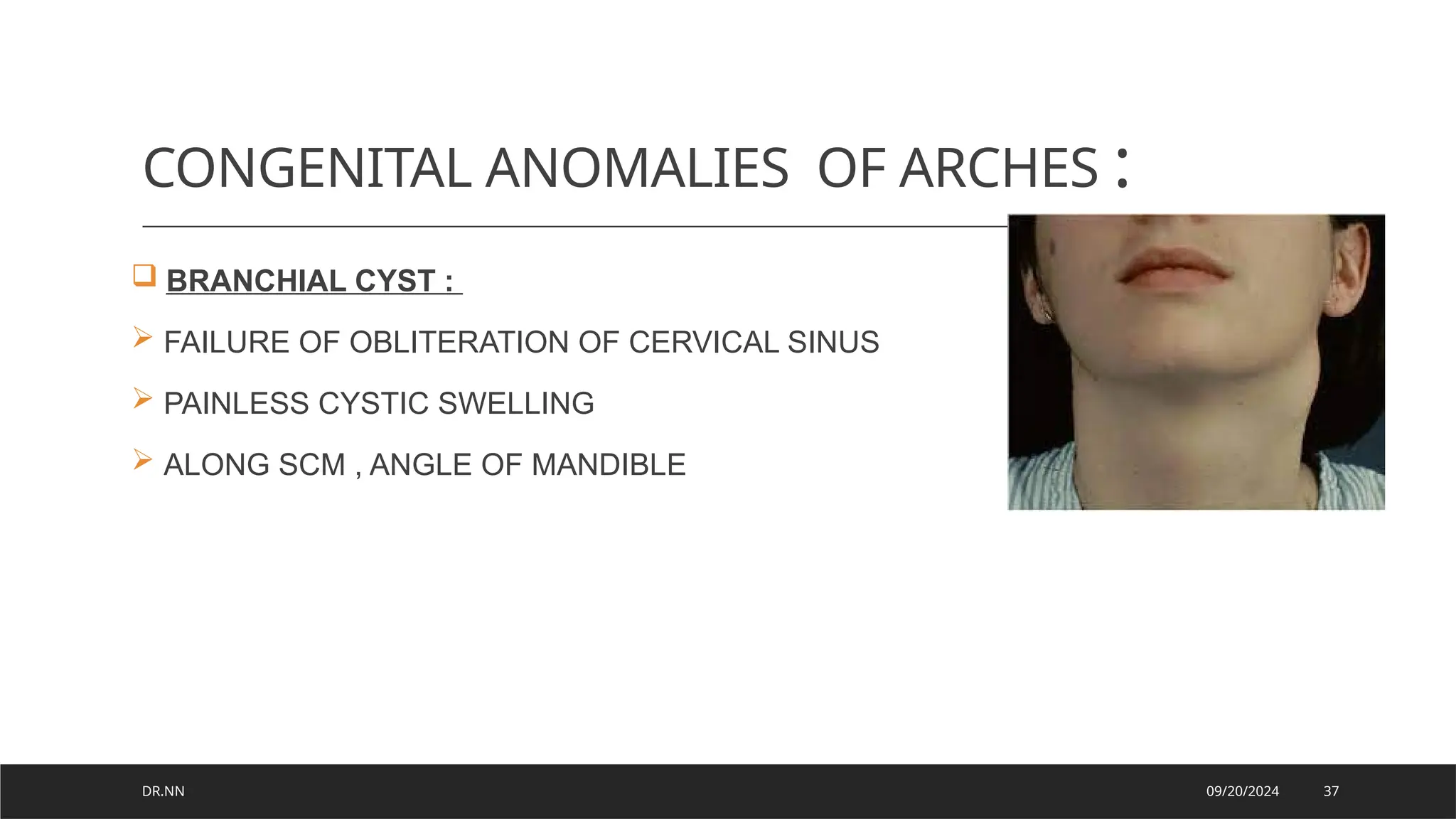 Development of Pharyngeal arches and derivatives.pptx