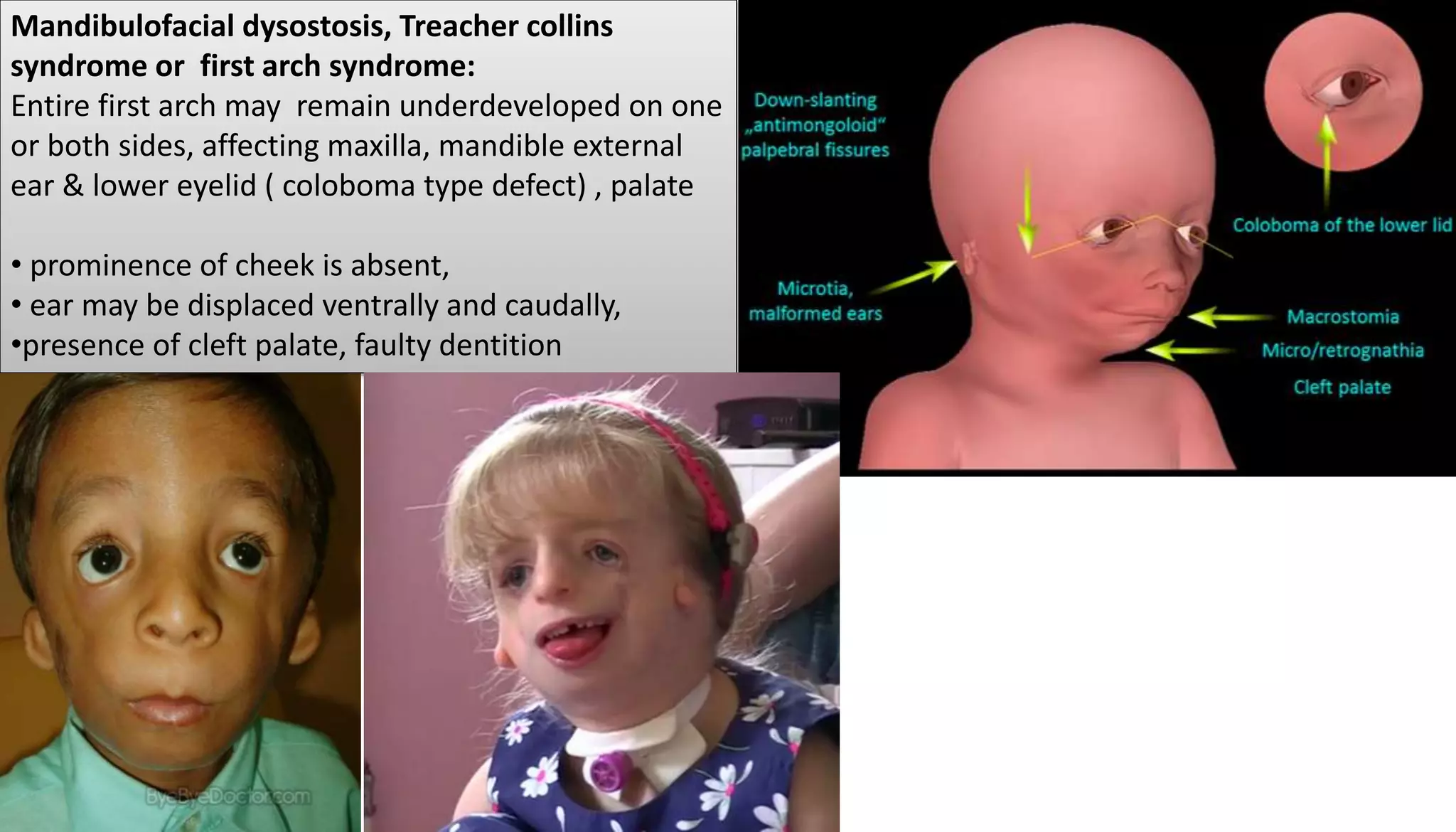 Pharyngeal arches & pouches | PPTX