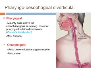 Pharyngo-oesophageal diverticula:
 Pharyngeal:
-Majority arise above the
cricopharyngeus muscle eg. posterior
pharyngeal pulsion diverticulum
(Zenker’s diverticulum)
-Most frequent
 Oesophageal:
-Arise below cricopharyngeus muscle
-Uncommon
 