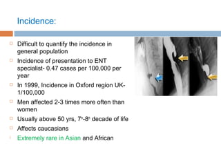 Incidence:
 Difficult to quantify the incidence in
general population
 Incidence of presentation to ENT
specialist- 0.47 cases per 100,000 per
year
 In 1999, Incidence in Oxford region UK-
1/100,000
 Men affected 2-3 times more often than
women
 Usually above 50 yrs, 7th
-8th
decade of life
 Affects caucasians
 Extremely rare in Asian and African
 