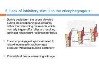 2. Lack of inhibitory stimuli to the cricopharyngeus:
 During deglutition- the larynx elevated
pulling the cricopharyngeus upwards
rather than stretching the muscle which
normally trigger off a reflex arc resulting
sphincter relaxationreadiness for bolus
 The cricopharyngeal sphincter failed to
relaxincreased intrapharyngeal
pressure mucosal bulging posteriorly
 Prevertebral fascia weakening with age
 