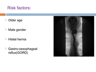 Risk factors:
 Older age
 Male gender
 Hiatal hernia
 Gastro-oesophageal
reflux(GORD)
 