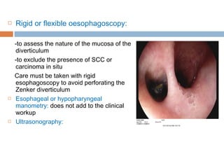  Rigid or flexible oesophagoscopy:
-to assess the nature of the mucosa of the
diverticulum
-to exclude the presence of SCC or
carcinoma in situ
Care must be taken with rigid
esophagoscopy to avoid perforating the
Zenker diverticulum
 Esophageal or hypopharyngeal
manometry: does not add to the clinical
workup
 Ultrasonography:
 