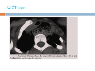  CT scan:
 
