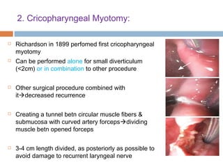 2. Cricopharyngeal Myotomy:
 Richardson in 1899 perfomed first cricopharyngeal
myotomy
 Can be performed alone for small diverticulum
(<2cm) or in combination to other procedure
 Other surgical procedure combined with
itdecreased recurrence
 Creating a tunnel betn circular muscle fibers &
submucosa with curved artery forcepsdividing
muscle betn opened forceps
 3-4 cm length divided, as posteriorly as possible to
avoid damage to recurrent laryngeal nerve
 