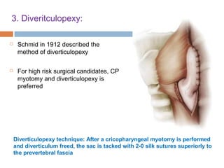3. Diveritculopexy:
 Schmid in 1912 described the
method of diverticulopexy
 For high risk surgical candidates, CP
myotomy and diverticulopexy is
preferred
Diverticulopexy technique: After a cricopharyngeal myotomy is performed
and diverticulum freed, the sac is tacked with 2-0 silk sutures superiorly to
the prevertebral fascia
 