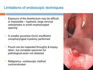 Limitations of endoscopic techniques:
 Exposure of the diverticulum may be difficult
or impossible – kyphosis, large cervical
osteophytes or small oropharyngeal
opening
 In smaller pouches(<2cm) insufficient
cricopharyngeal myotomy performed
 Pouch can be inspected throughly & biopsy
taken, but complete specimen for
pathological exam not obtained
 Malignancy –endoscopic method
contraindicated
 