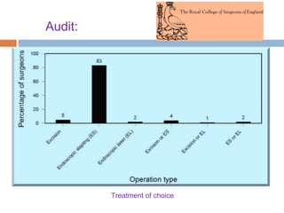 Treatment of choice
Audit:
 