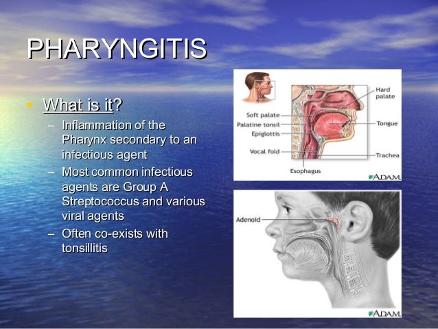 Pharyngitis as related to AlstrÃ¶m syndrome - Pictures
