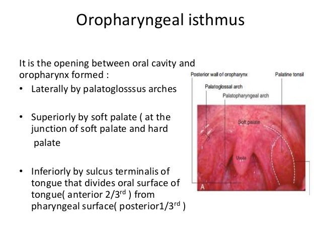 Pharyngitis n oral cavity