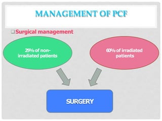 Surgical management
25%of non-
irradiated patients
60%of irradiated
patients
SURGERY
MANAGEMENT OF PCF
 