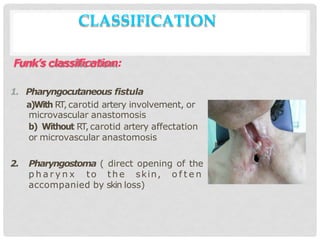 CLASSIFICATION
Funk’s classification:
1. Pharyngocutaneous fistula
a)With RT,carotid artery involvement, or
microvascular anastomosis
b) Without RT, carotid artery affectation
or microvascular anastomosis
2. Pharyngostoma ( direct opening of the
p h a r y n x to the skin, o f t e n
accompanied by skin loss)
 