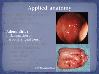  Tonsillitis : inflammation
of palatine tonsil
 Quinsy: peritonsillar
abscess
 Adenoiditis :
inflammation of
nasopharyngeal tonsil
 Zenker’s diverticulum :
due to neuromuscular
incoordination of
inf.constrictor
(accumulated food causes
a mucosal pouch in
killian’s dehiscence).©Dr.N.Mugunthan
 