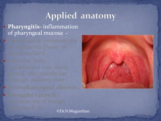  Pharyngitis- inflammation
of pharyngeal mucosa -
 Nasopharynx -common site
of carcinoma [Fossa of
Rosen muller ].
 Infection from
nasopharynx can easily
spread into middle ear
through auditory tube.
 Retropharyngeal abscess.
 Smuggler's pouch (
common site of foreign
body stuck up)
©Dr.N.Mugunthan
 