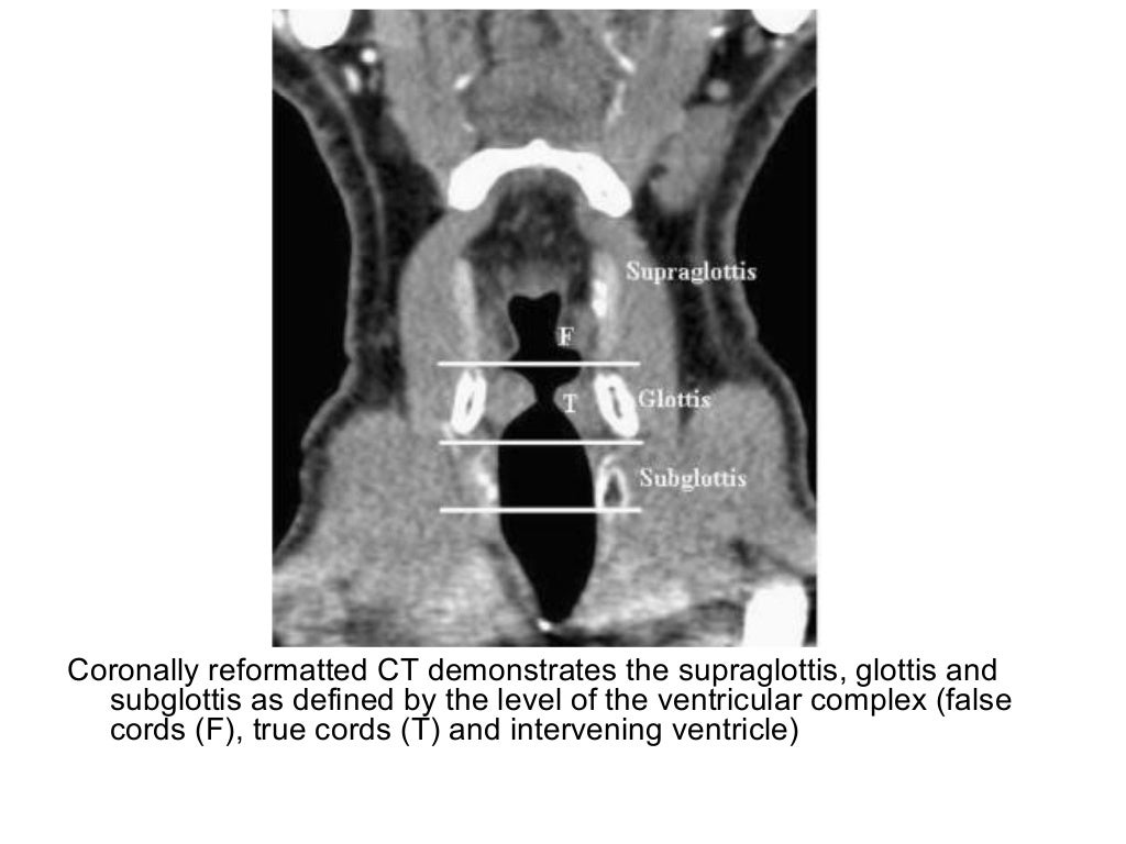 Diagnostic Imaging of Pharynx & Larynx