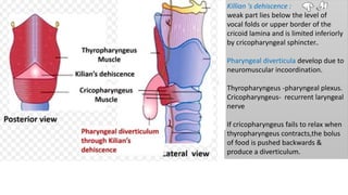 Killian 's dehiscence :
weak part lies below the level of
vocal folds or upper border of the
cricoid lamina and is limited inferiorly
by cricopharyngeal sphincter..
Pharyngeal diverticula develop due to
neuromuscular incoordination.
Thyropharyngeus -pharyngeal plexus.
Cricopharyngeus- recurrent laryngeal
nerve
If cricopharyngeus fails to relax when
thyropharyngeus contracts,the bolus
of food is pushed backwards &
produce a diverticulum.
 