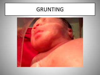 GRUNTING
 