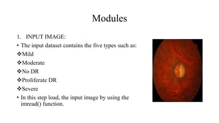 Modules
1. INPUT IMAGE:
• The input dataset contains the five types such as:
Mild
Moderate
No DR
Proliferate DR
Severe
• In this step load, the input image by using the
imread() function.
 