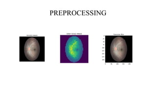 PREPROCESSING
 
