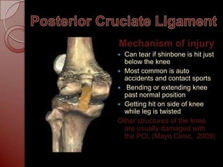 Pcl Mechanism Of Injury