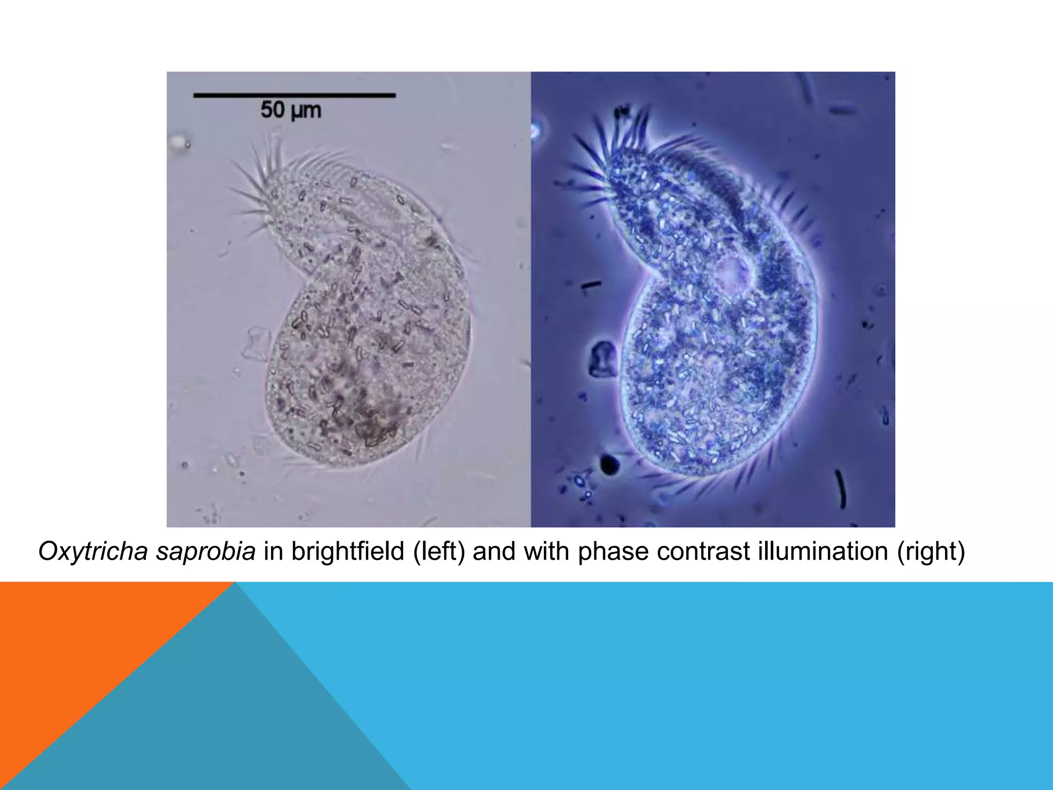 Oxytricha saprobia in brightfield (left) and with phase contrast illumination (right)
 