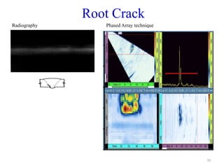 30
Root Crack
Radiography Phased Array technique
 