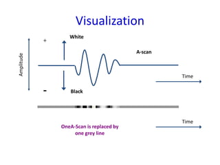 Visualization
White
+
Black
-
Amplitude
Time
Time
OneA-Scan is replaced by
one grey line
A-scan
41
 