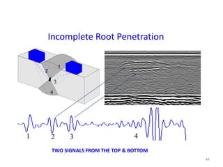 44
TWO SIGNALS FROM THE TOP & BOTTOM
1
2
3
4
1 2 3 4
Incomplete Root Penetration
 