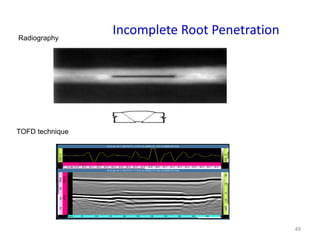 49
Incomplete Root Penetration
TOFD technique
Radiography
 