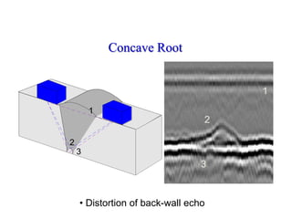 Concave Root
• Distortion of back-wall echo
1
2
3
1
2
3
 