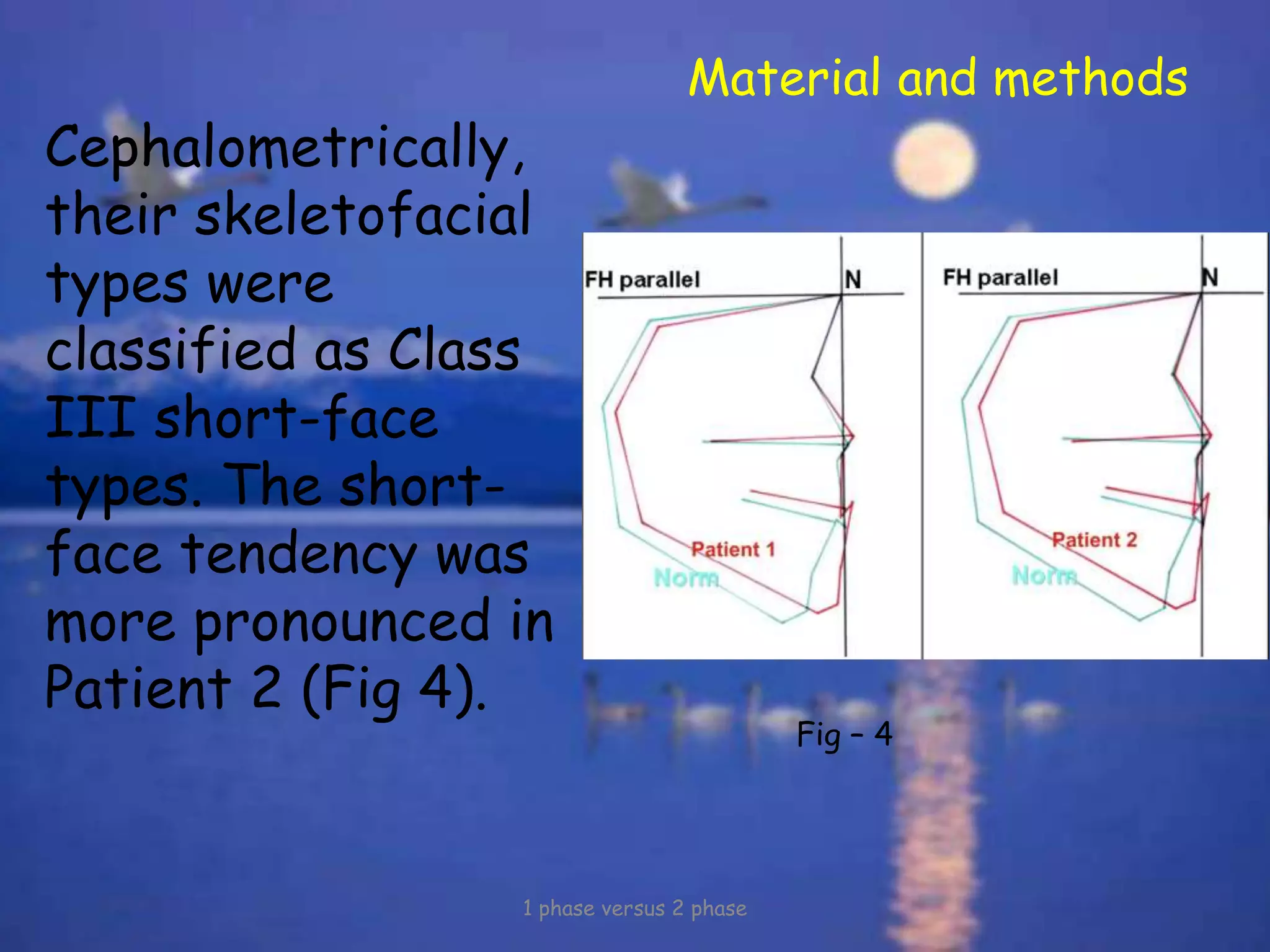 Material and methods
Cephalometrically,
their skeletofacial
types were
classified as Class
III short-face
types. The short-
face tendency was
more pronounced in
Patient 2 (Fig 4).
1 phase versus 2 phase
Fig – 4
 