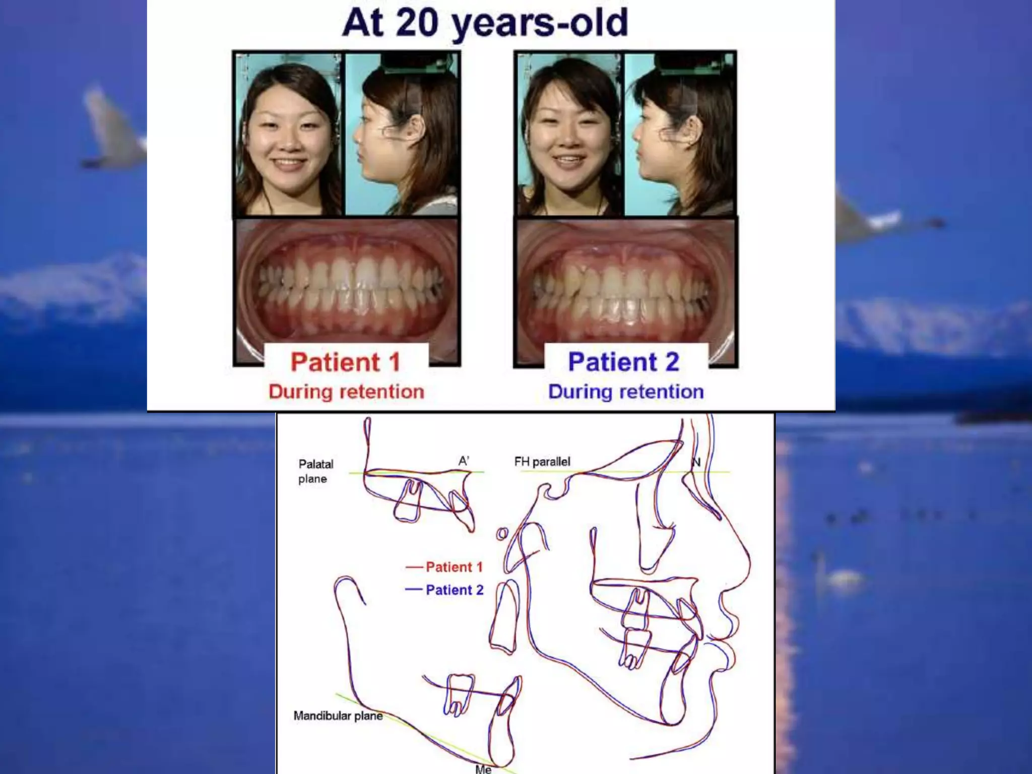 1 phase versus 2 phase
 